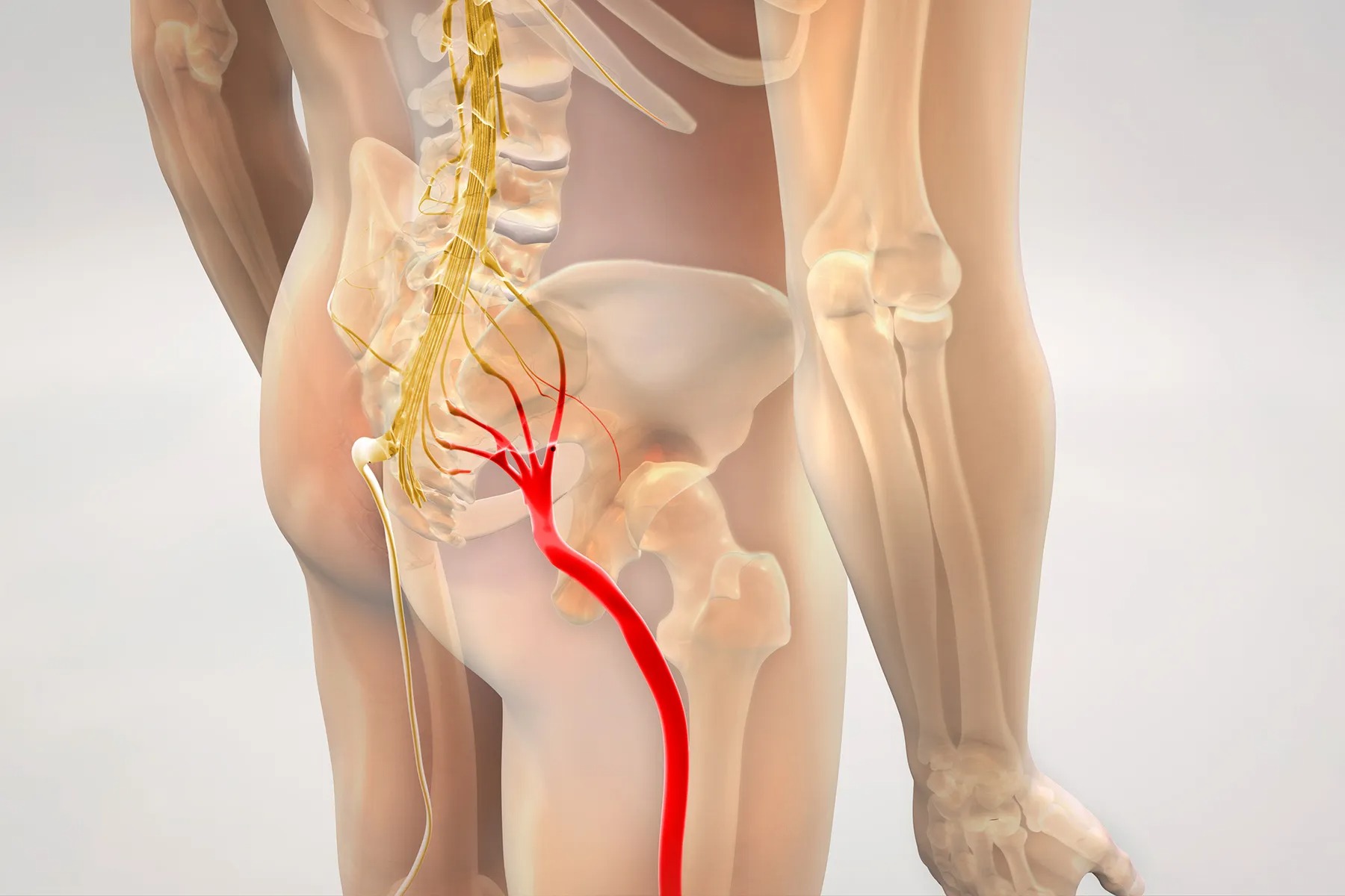 Sciatica Pain Relief